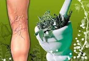 barishte për trajtimin e venave me variçe