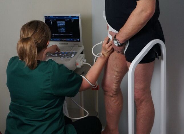 ekzaminimi i venave para koagulimit me lazer për venat me variçe